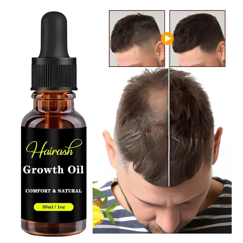 Wig Glue For Lace Front Waterproof Hair Mousse Glue Pen Wax Stick Hair Growth Oil Glue Remover Melt Band With Ear Cover